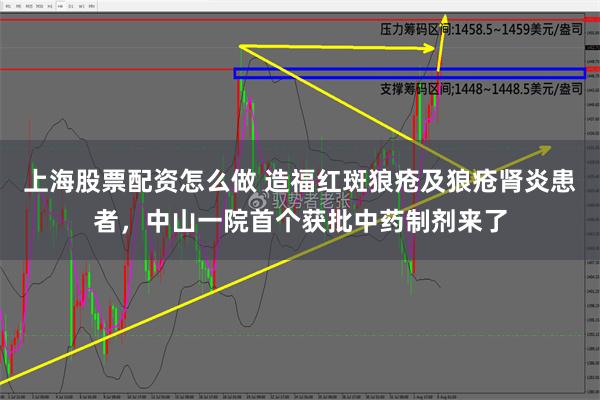 上海股票配资怎么做 造福红斑狼疮及狼疮肾炎患者，中山一院首个获批中药制剂来了